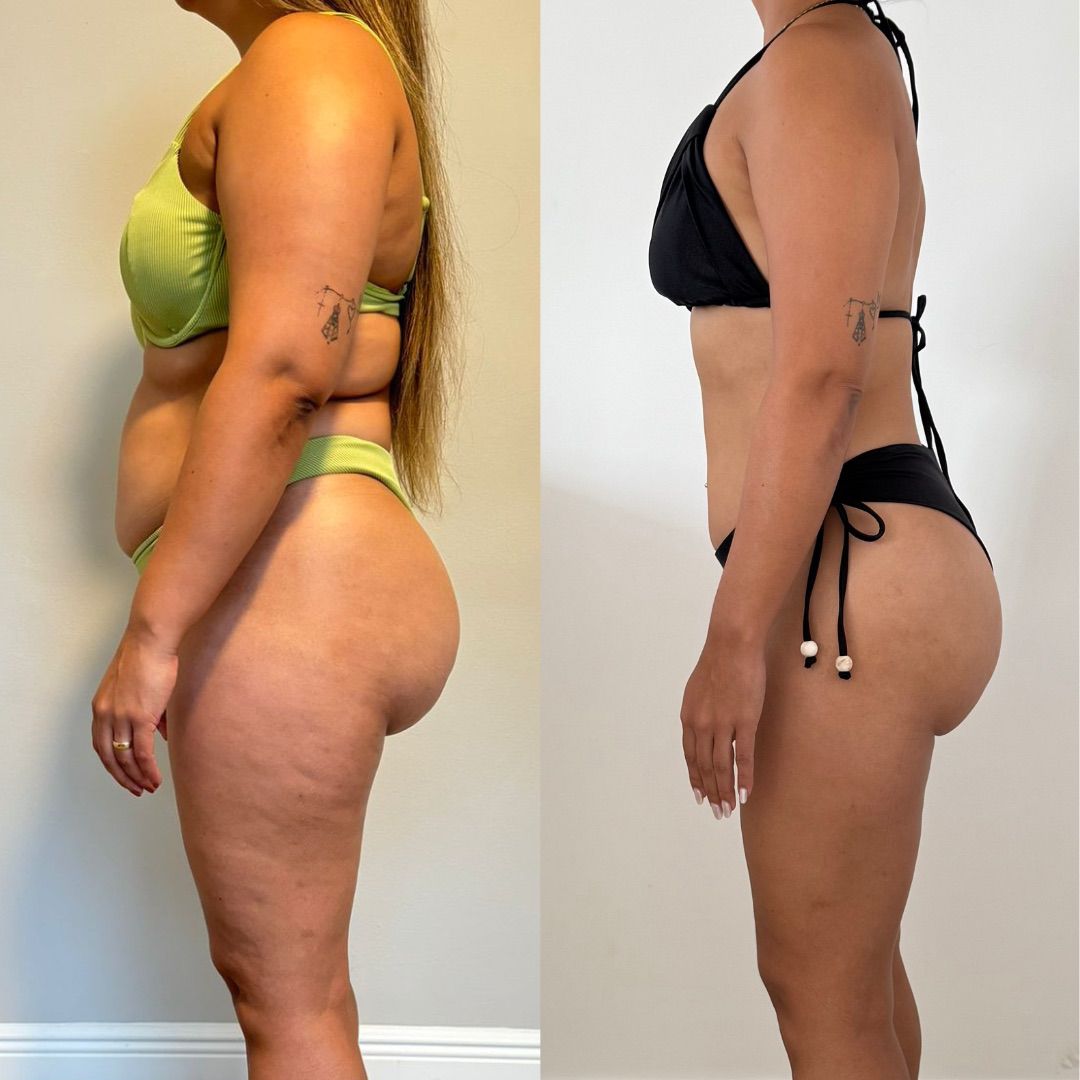 Antes e depois de uma aluna do acompanhamento, de perfil