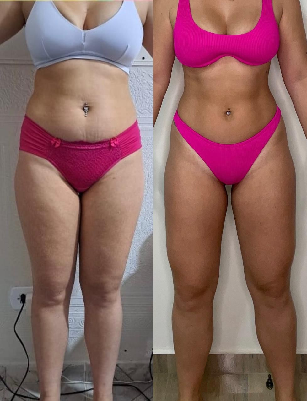Antes e depois de uma aluna do acompanhamento, de frente